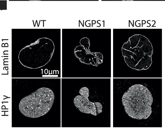 Open access visualization of Microscopy, High Resolution Microscopy, Heterochromatin Marker, HP1γ, Cells