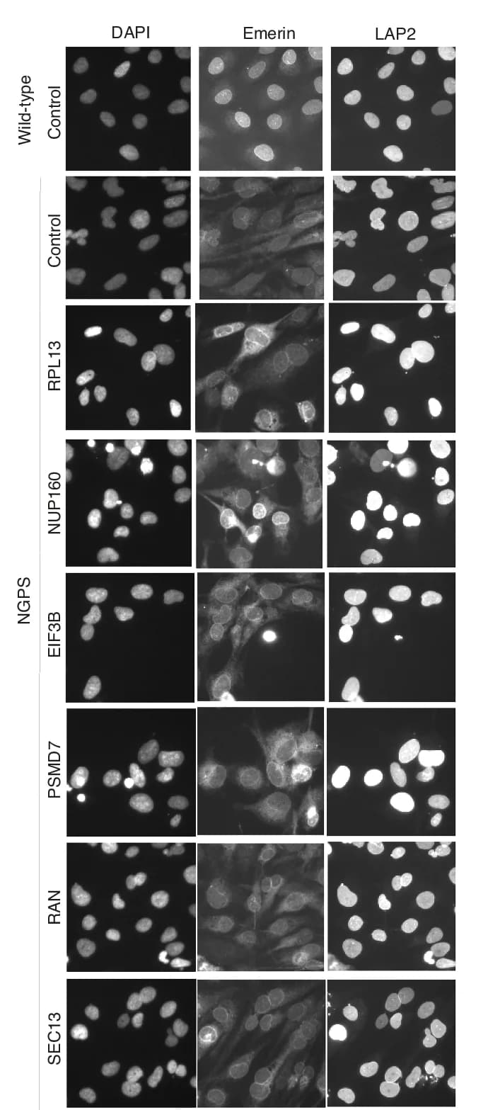 Open access visualization of Microscopy, Immunofluorescence, Nuclear Envelope, Phenotypes, Validation Screen