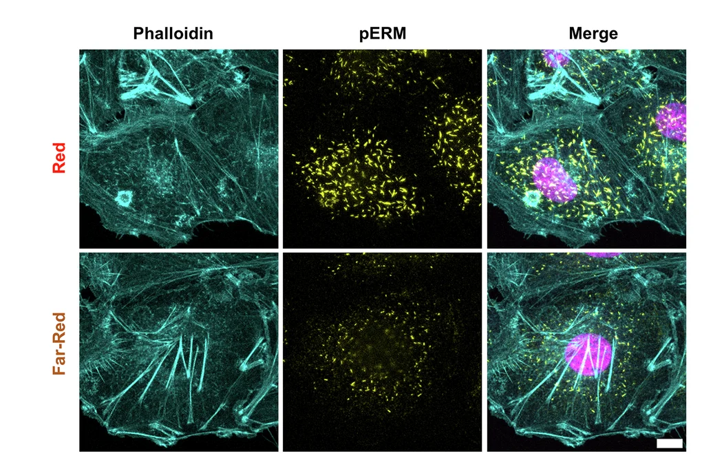 Open access visualization of Microscopy, Confocal Fluorescence Images, Cph1-PM-MDA Cells, Phalloidin, Anti-pERM Antibody