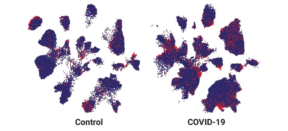 Open access visualization of Scatter Plot, UMAP, Control Cells, COVID-19 Cells, SenePy Outlier Cells