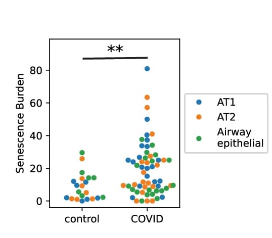 Open access visualization of Scatter Plot, Outlier Cells, SenePy, AT1, AT2