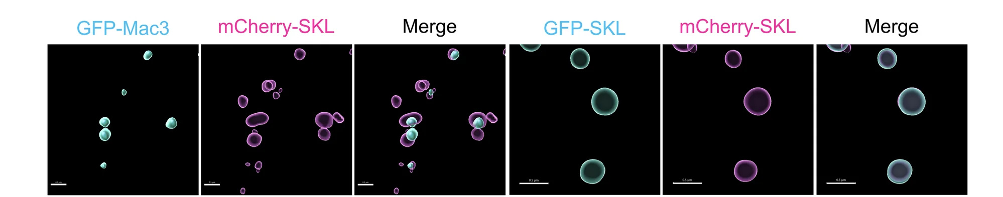 Open access visualization of Microscopy, 3D-Reconstruction, GFP-Mac3, GFP-SKL, Peroxisomes