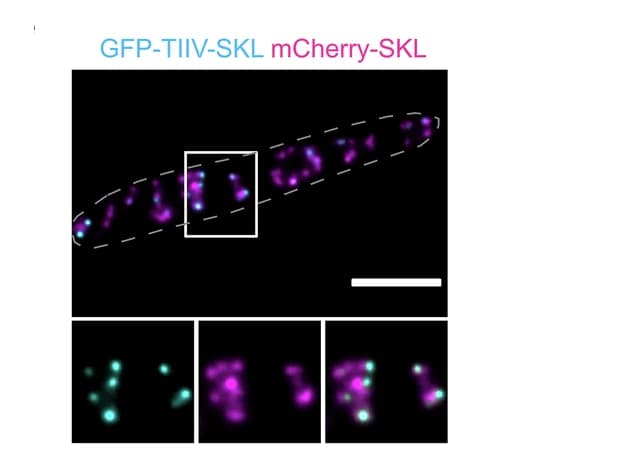 Open access visualization of Microscopy, GFP, TIIV, PTS1, SKL