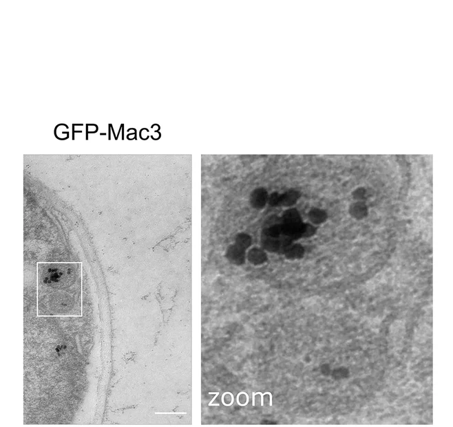 Open access visualization of Microscopy, Reporter Proteins, Organelle Preparations, Epifluorescence Microscopy, Lysis Buffer