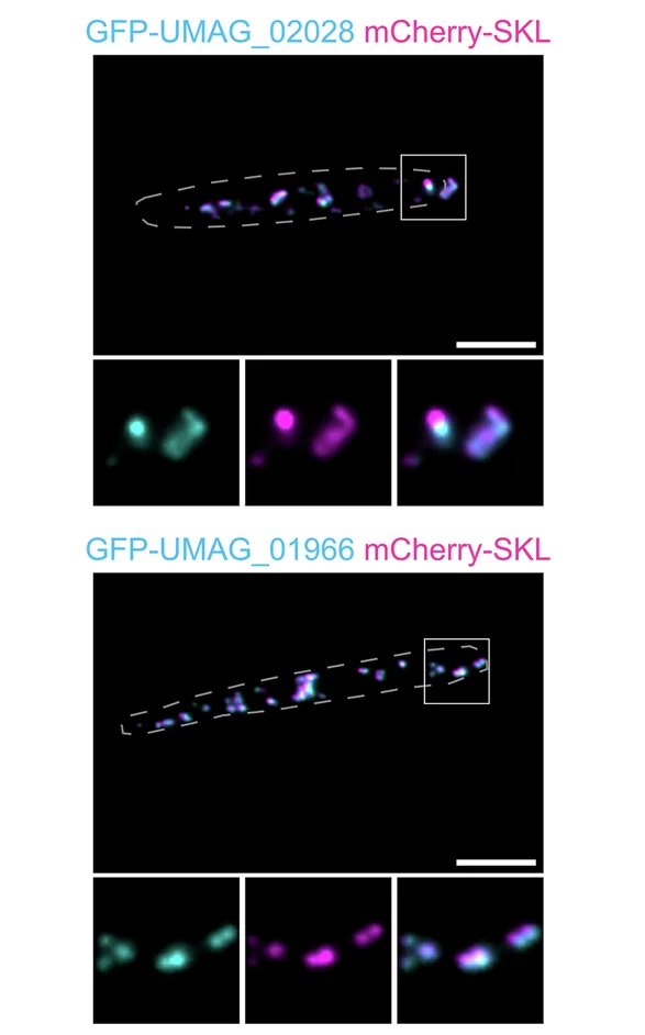 Open access visualization of Microscopy, Epifluorescence Images, Cells, GFP, Acyl-CoA Oxidases