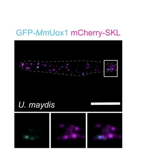 Open access visualization of Microscopy, Urate Oxidase, GFP, mCherry-SKL, mCherry-Mac3