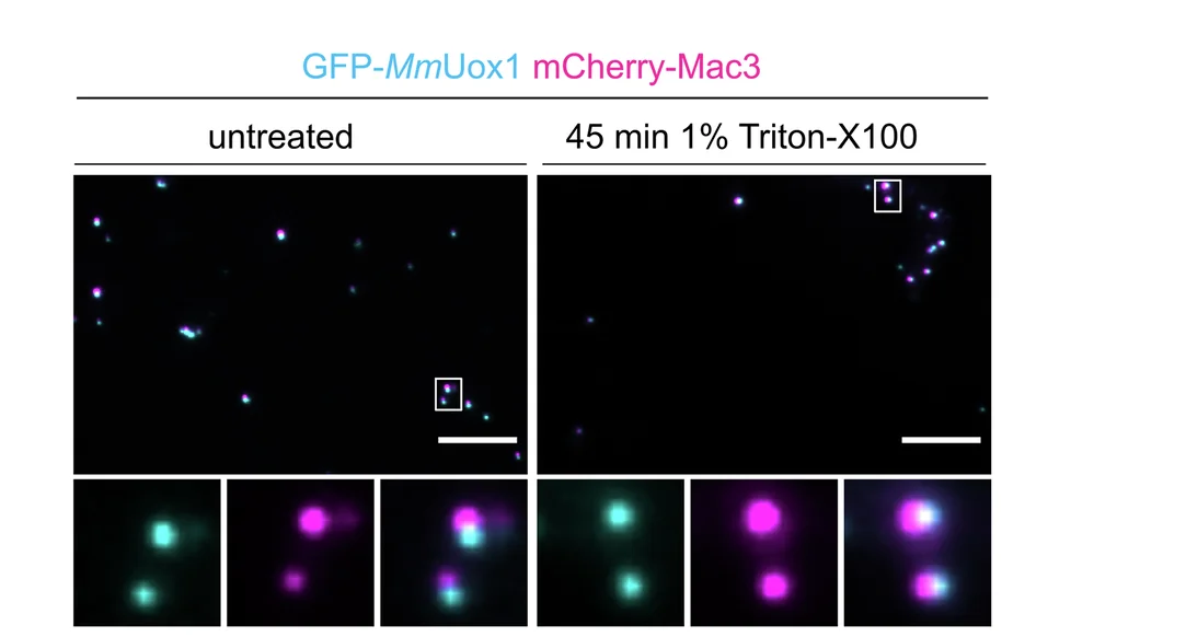 Open access visualization of Microscopy, Organelle Preparations, Epifluorescence Microscopy, Lysis Buffer, Triton X-100