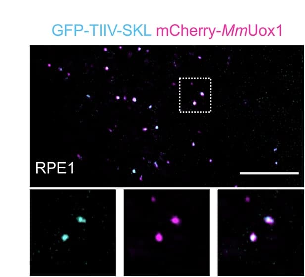 Open access visualization of Microscopy, Urate Oxidase, mCherry, GFP-TIIV-SKL, RPE1 Cells