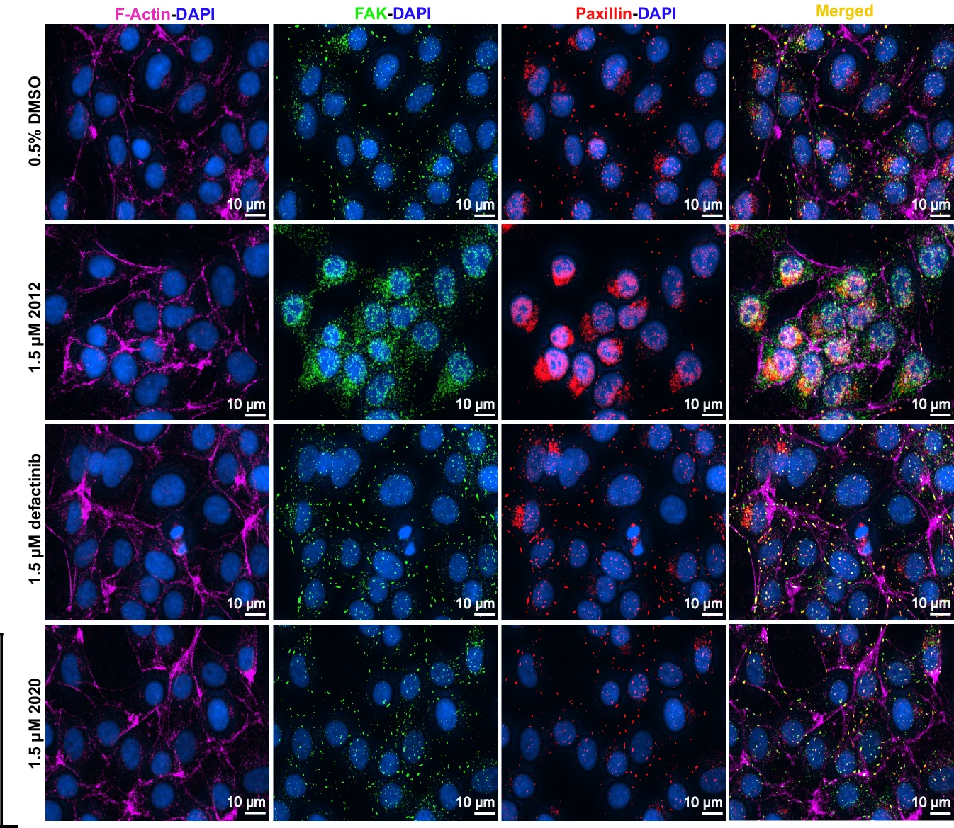 Open access visualization of Microscopy, Immunofluorescence, F-actin, FAK, Paxillin