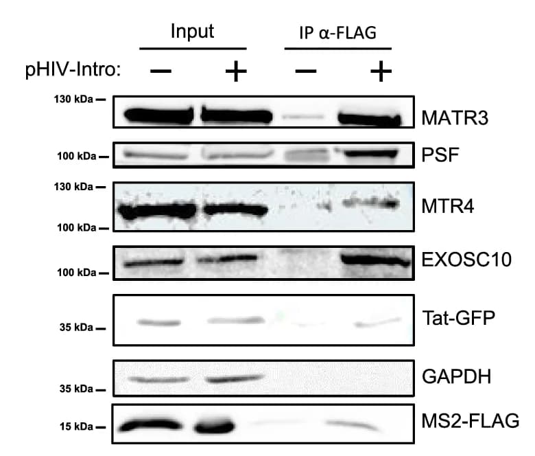 Open access visualization of Gel, 293 T Cells, Transfection, Cell Lysates, Immunoprecipitation