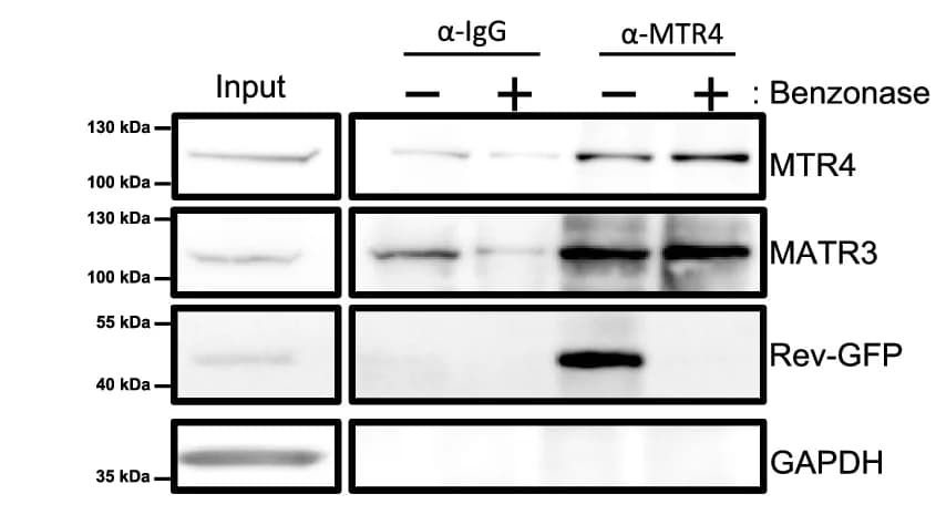Open access visualization of Gel, 293 T Cells, Transfection, Cell Lysates, Immunoprecipitation