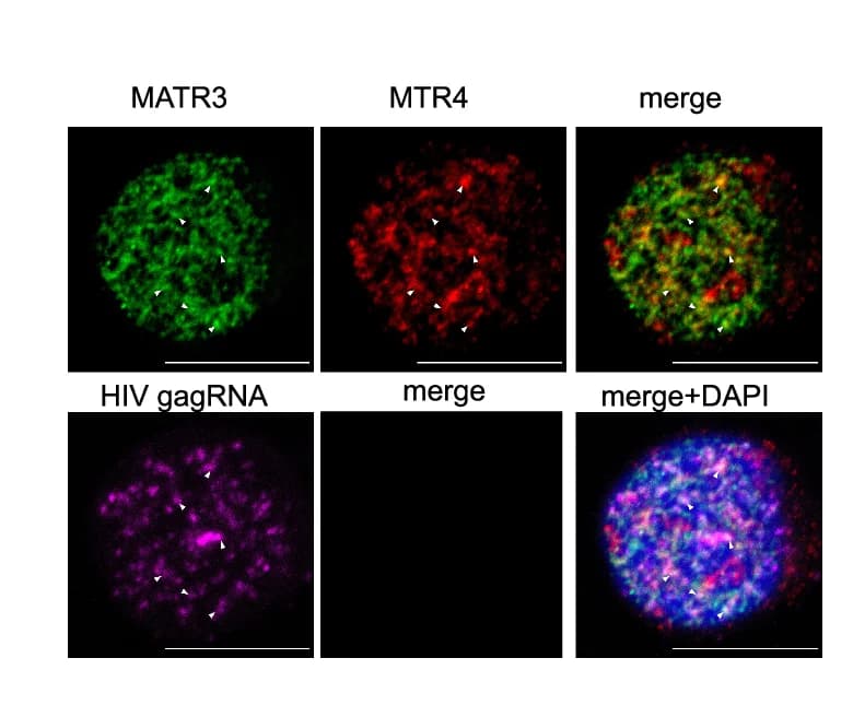 Open access visualization of Microscopy, J-Lat 9.2 Cells, TNF Stimulation, RNA FISH, Immunostaining