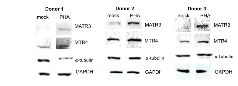 Open access visualization of Gel, PBMCs, Immunoblotting, Antibodies, Loading Controls