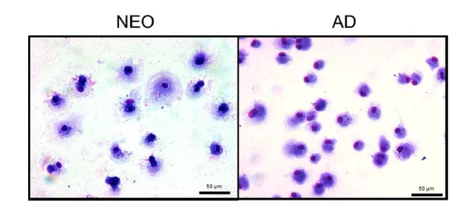 Open access visualization of Microscopy, Morphology, Macrophages, May-Grunwald-Giemsa Staining