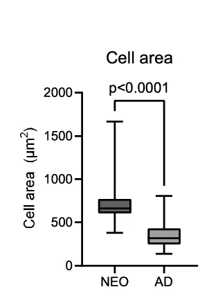 Open access visualization of Box Plot, Cell Area, Macrophages