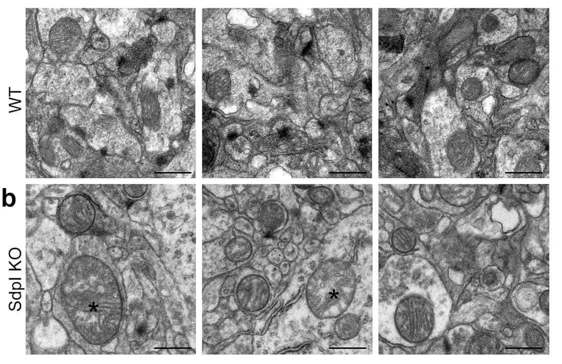 Open access visualization of Microscopy, Transmission Electron Microscopy, Brain Sections, Mitochondria, Neurons