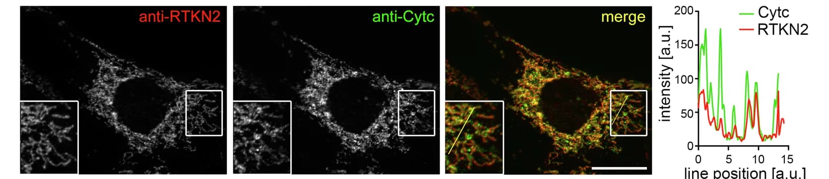 Open access visualization of Microscopy, Line Plot, NIH3T3 Cells, Rhotekin2, Cytochrome C