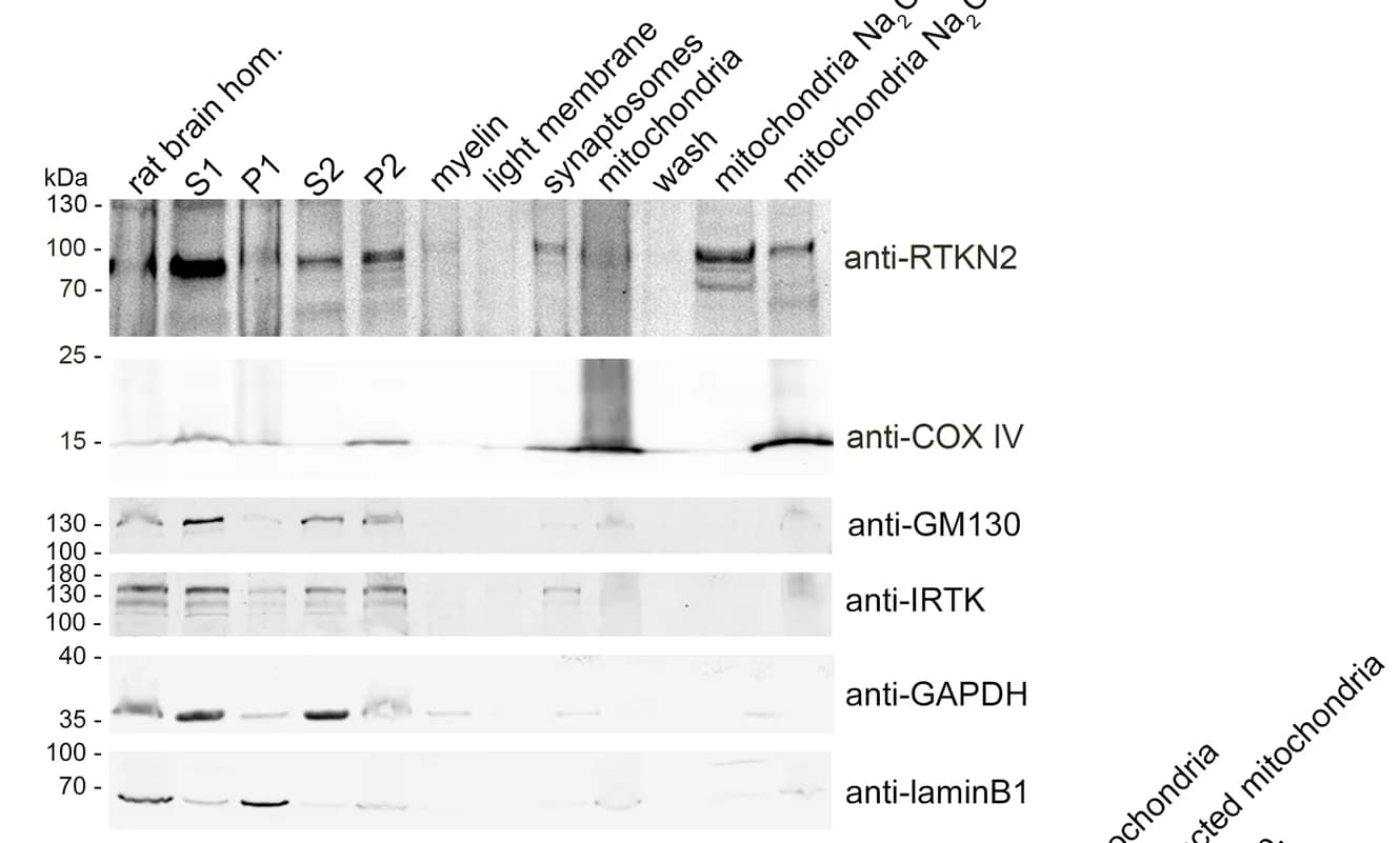 Open access visualization of Gel, Brain Homogenate, Rats, Mitochondria, Cytochrome C Oxidase