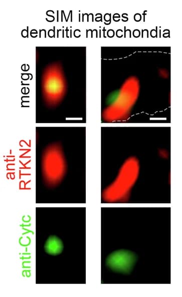 Open access visualization of Microscopy, Hippocampal Neurons, Dendritic Mitochondria, Rhotekin2, Cytochrome C