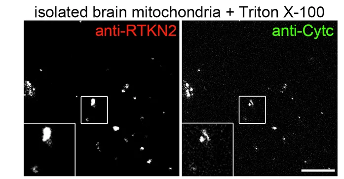 Open access visualization of Microscopy, Mouse Brain Mitochondria, Rhotekin2, Cytochrome C, Immunostaining