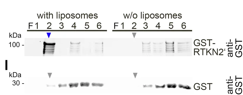 Open access visualization of Gel, GST, Rhotekin2, Liposomes, Density Gradient Fractionation