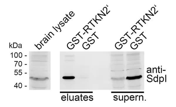 Open access visualization of Gel, Immunoblotting, Coprecipitation, Rhotekin2, Syndapin I