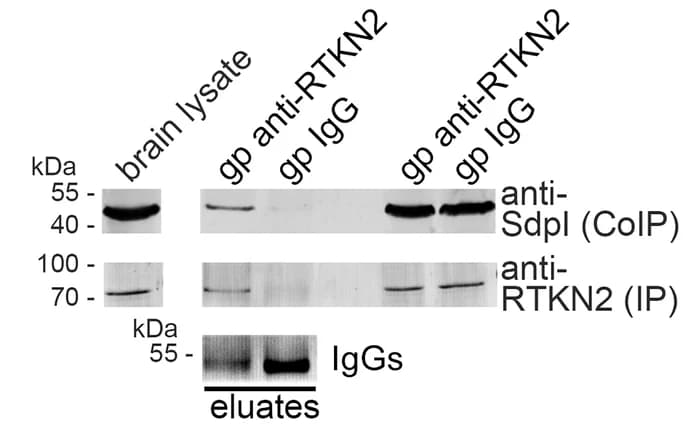 Open access visualization of Gel, Immunoblotting, Coimmunoprecipitation, Rhotekin2, Syndapin I