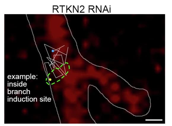 Open access visualization of Microscopy, SIM Image, mitoGFP, mCherryF, Developing Neuron