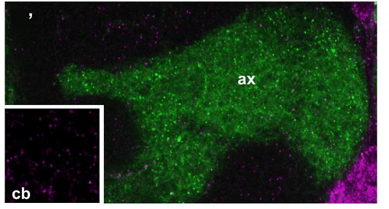 Open access visualization of Microscopy, smFISH Signals, Adult Brains, gfp, MB Axons