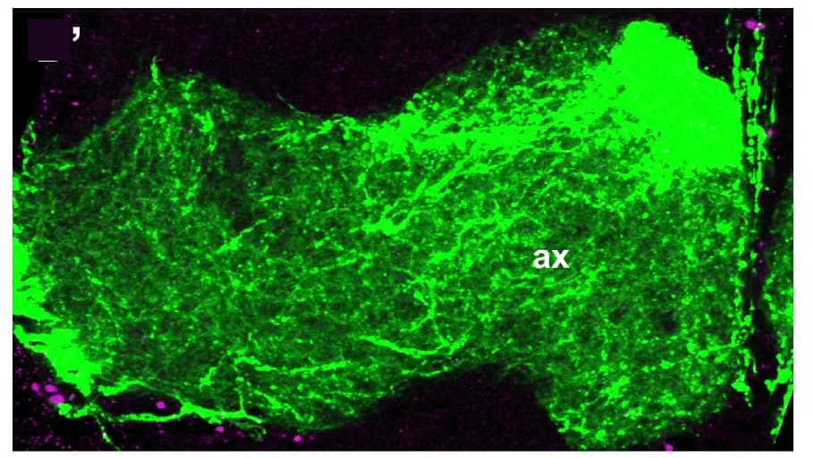 Open access visualization of Microscopy, Confocal Images, smFISH, Brains, MB Axons