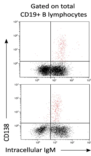 Open access visualization of Scatter Plot, Histograms, Lymphocytes, Septic Patients, Plasma Cells