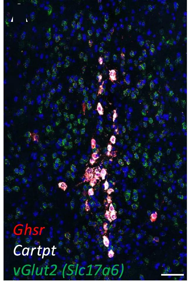 Open access visualization of Microscopy, EWcp, Ghsr, Cartpt, vGlut2