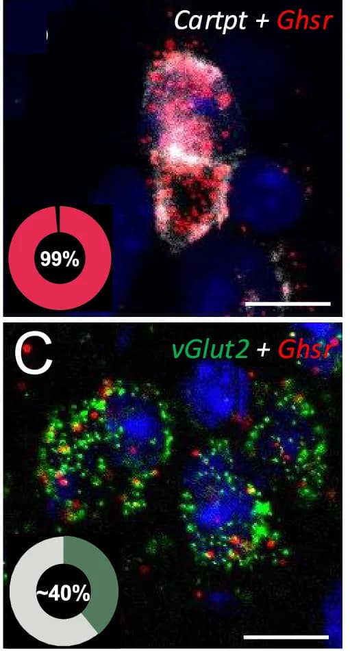 Open access visualization of Microscopy, Pie Chart, Microphotograph, Ghsr, Cartpt