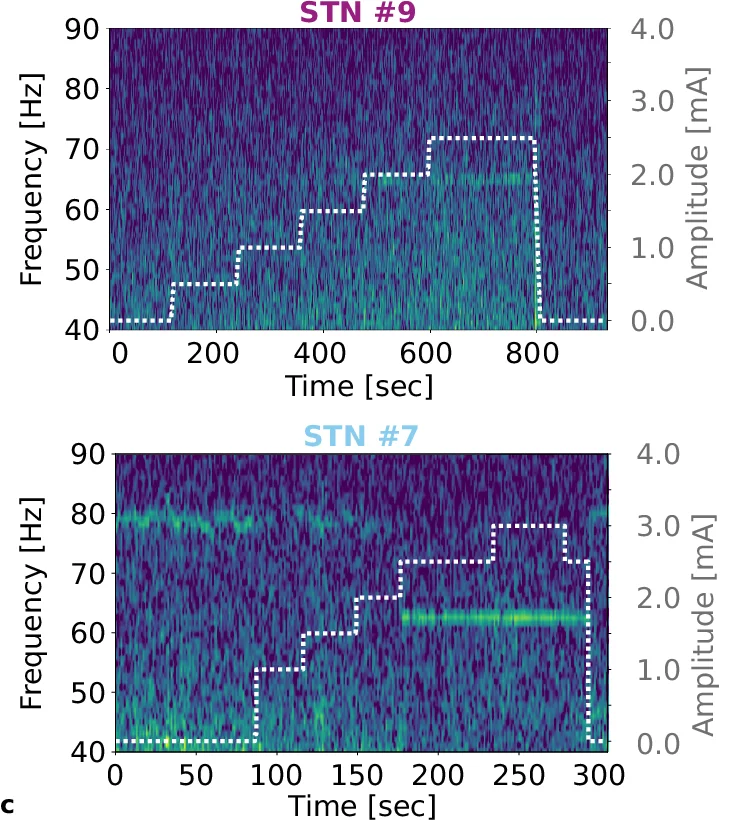 Open access visualization of Spectrogram, Entrainment, DBS, FTG Activity, Amplitude