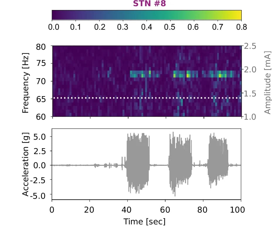Open access visualization of Heatmap, Line Plot, Spectrogram, STN, Stimulation