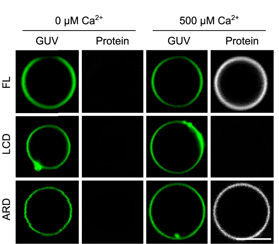 Open access visualization of Microscopy, Fluorescence Images, Giant Unilamellar Vesicles, ANXA11, Calcium