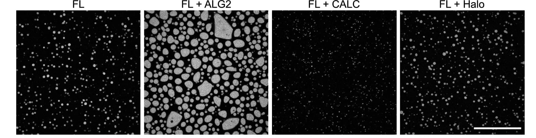 Open access visualization of Microscopy, Fluorescence Micrographs, AF647-ANXA11 FL, ALG2, CALC