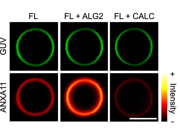 Open access visualization of Microscopy, Fluorescence Images, ATTO488 GUVs, AF647-ANXA11 FL, Calcium