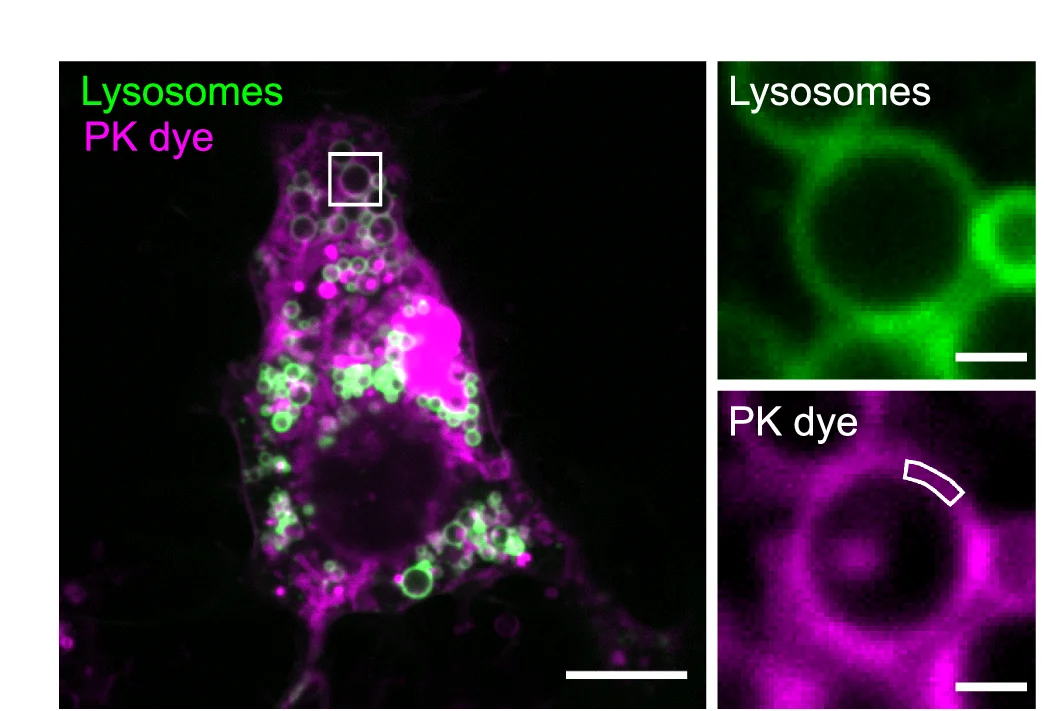 Open access visualization of Microscopy, Photo, Hypotonic U2OS Cell, Lysosomes, PK Dye