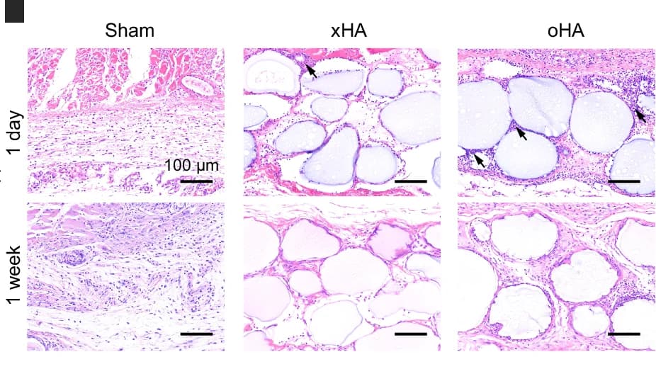 Open access visualization of Microscopy, Histology Images, H&E Staining, Subcutaneous Implantation, Inflammatory Cells