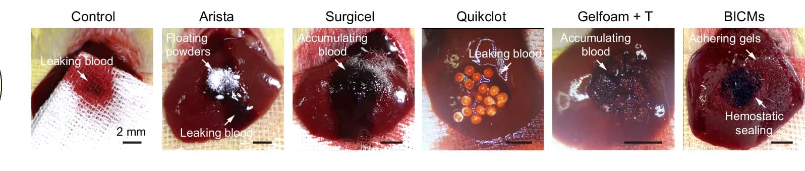 Open access visualization of Photo, Hemostatic Performance, Gauze, Arista, Surgicel