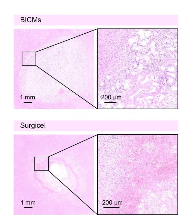 Open access visualization of Microscopy, Histology Images, H&E Staining, Injured Livers, Statistical Analysis