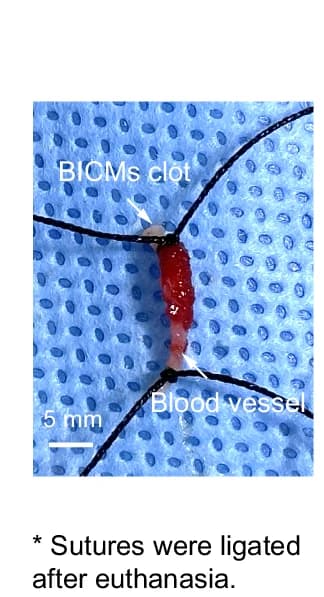 Open access visualization of Photo, Photographs, Blood Vessel, Hemostasis, BICMs