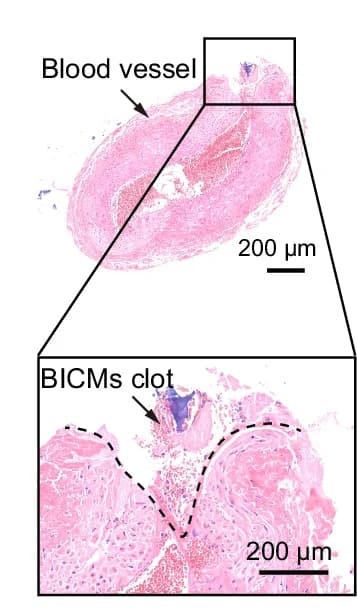 Open access visualization of Microscopy, Histological Images, H&E Staining, Blood Vessel, Hemostasis