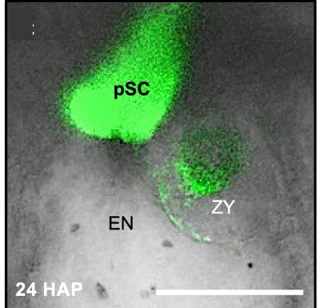 Open access visualization of Microscopy, Synergid Cell, Degeneration, GFP Marker, Egg Cell