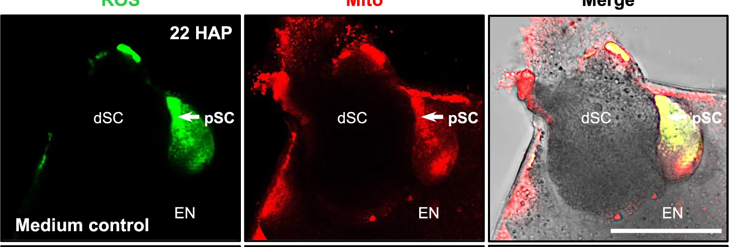 Open access visualization of Microscopy, ROS Scavenger, Synergid Cell, Ovules, Culture Medium