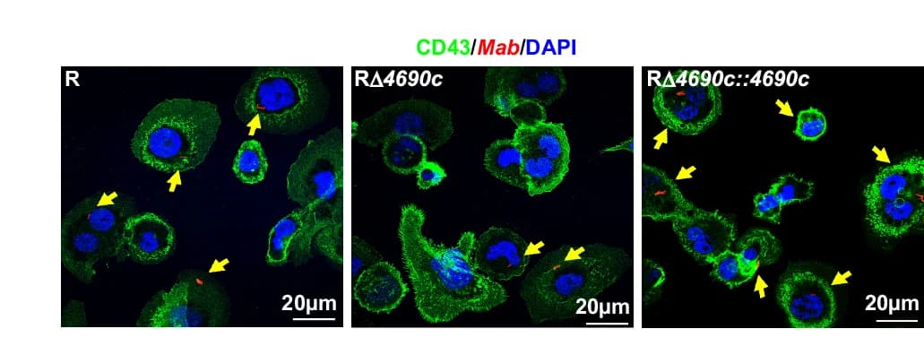 Open access visualization of Microscopy, Immunofluorescence Images, THP-1 Cells, Infected Cells, Bacteria