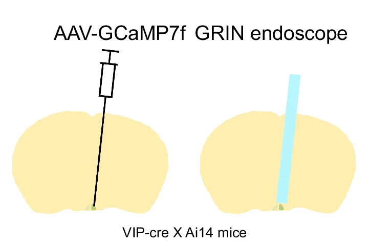 Open access visualization of Illustration, Recording Setup, Surgical Procedure, Mouse Brain