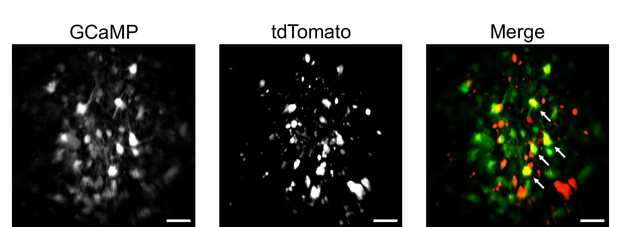 Open access visualization of Microscopy, GCaMP, tdTomato, Two-photon System, Colocalization