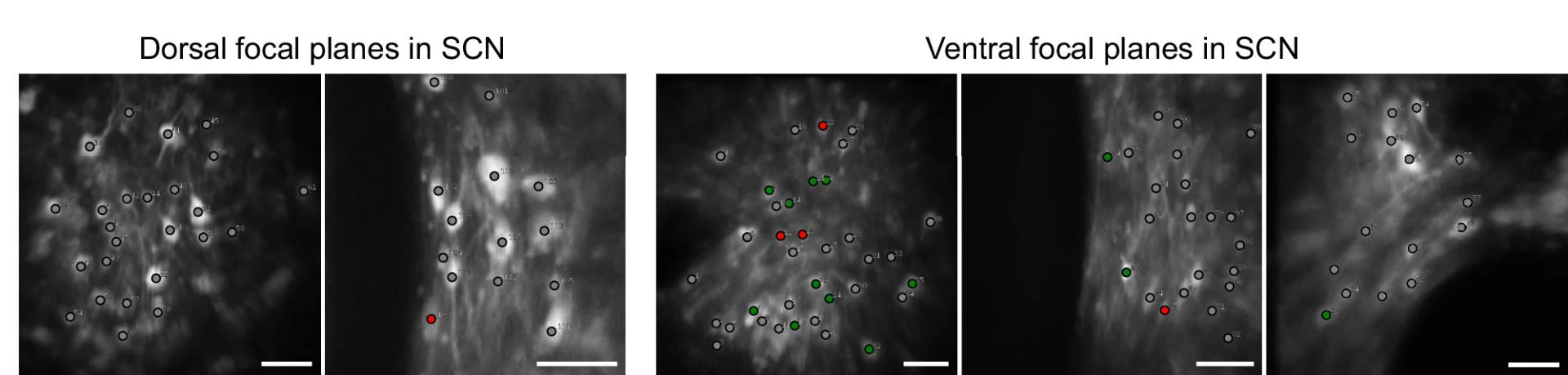 Open access visualization of Microscopy, Neuron Groups, Raw Images, Cell Body, GRIN Endoscope